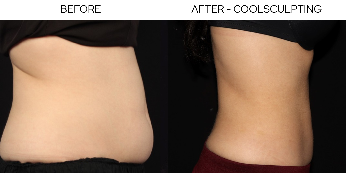 Before and After Result