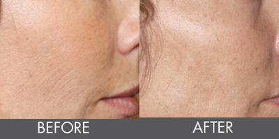 Secret RF B&A